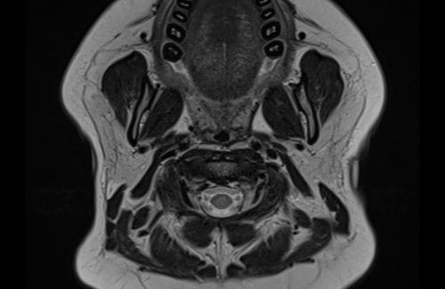 La Pintada Hotel | Habitación doble, con desayuno - La Casona Hotel